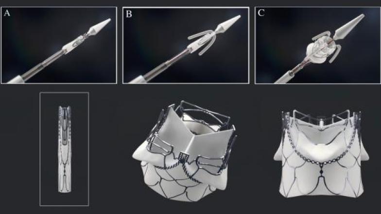 SAT Deployment System